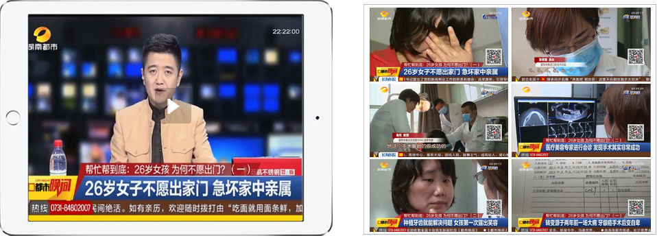 愛思特